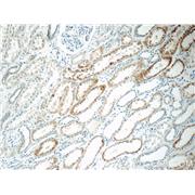 C1QTNF3 Rabbit Polyclonal Antibody (11414-1-AP)