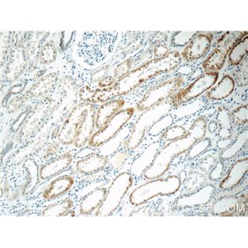 C1QTNF3 Rabbit Polyclonal Antibody (11414-1-AP)