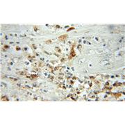 PFN1 Rabbit Polyclonal Antibody (11680-1-AP)