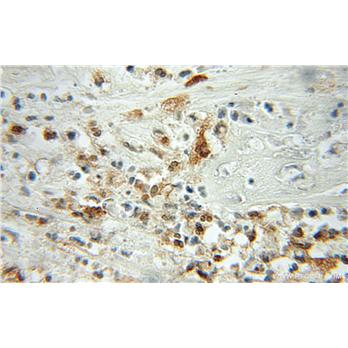 PFN1 Rabbit Polyclonal Antibody (11680-1-AP)