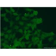 PTER Rabbit Polyclonal Antibody (11191-1-AP)