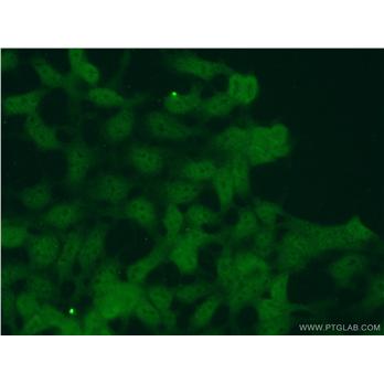 PTER Rabbit Polyclonal Antibody (11191-1-AP)