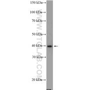 PRMT1 Rabbit Polyclonal Antibody (11279-1-AP)