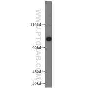 SCIN Rabbit Polyclonal Antibody (11579-1-AP)