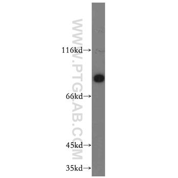 SCIN Rabbit Polyclonal Antibody (11579-1-AP)