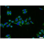 MRPL23 Rabbit Polyclonal Antibody (11706-1-AP)