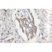 CAPN2 Rabbit Polyclonal Antibody (11472-1-AP)