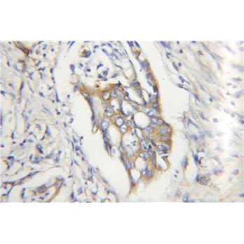 CAPN2 Rabbit Polyclonal Antibody (11472-1-AP)