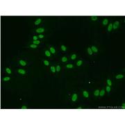 EAF2 Rabbit Polyclonal Antibody (11172-1-AP)