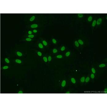 EAF2 Rabbit Polyclonal Antibody (11172-1-AP)