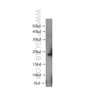 EIF1AX Rabbit Polyclonal Antibody (11649-2-AP)