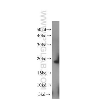 EIF1AX Rabbit Polyclonal Antibody (11649-2-AP)