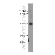 TFG Rabbit Polyclonal Antibody (11571-1-AP)