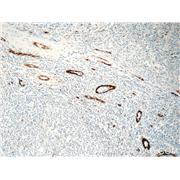 CCBP2 Rabbit Polyclonal Antibody (11386-1-AP)