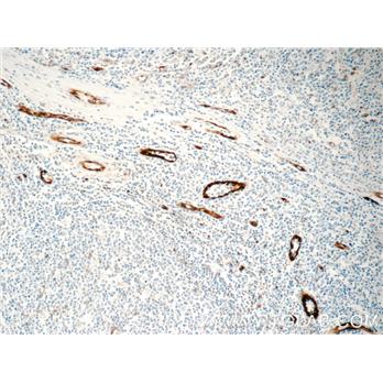 CCBP2 Rabbit Polyclonal Antibody (11386-1-AP)