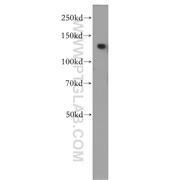 NEK9 Rabbit Polyclonal Antibody (11192-1-AP)