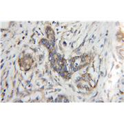 TIMM9 Rabbit Polyclonal Antibody (11479-1-AP)