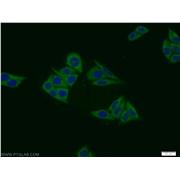 MIER1 Rabbit Polyclonal Antibody (11452-1-AP)