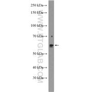 ASAH1 Rabbit Polyclonal Antibody (11274-1-AP)