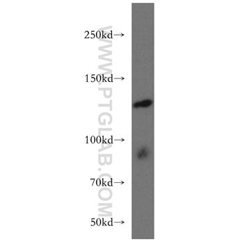 ARHGEF18 Rabbit Polyclonal Antibody (11243-1-AP)