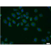 GPS1 Rabbit Polyclonal Antibody (11709-1-AP)
