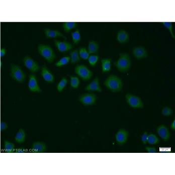 GPS1 Rabbit Polyclonal Antibody (11709-1-AP)