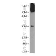 WSB1 Rabbit Polyclonal Antibody (11666-1-AP)