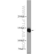 PPFIA3 Rabbit Polyclonal Antibody (11492-1-AP)