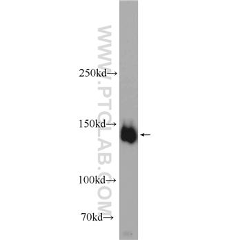 PPFIA3 Rabbit Polyclonal Antibody (11492-1-AP)