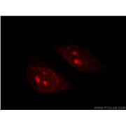 TINF2 Rabbit Polyclonal Antibody (11368-1-AP)