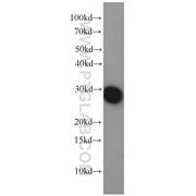 BCAP31 Rabbit Polyclonal Antibody (11200-1-AP)
