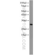 EIF4E Rabbit Polyclonal Antibody (11149-1-AP)