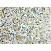 EHD2 Rabbit Polyclonal Antibody (11440-1-AP)