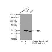 ABAT Rabbit Polyclonal Antibody (11349-1-AP)