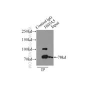 HSPA5 Rabbit Polyclonal Antibody (11587-1-AP)