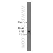 RASEF Rabbit Polyclonal Antibody (11569-1-AP)