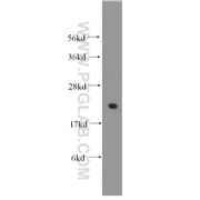 RPL13 Rabbit Polyclonal Antibody (11271-1-AP)