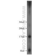 PPP1R14A Rabbit Polyclonal Antibody (11658-1-AP)