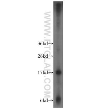 PPP1R14A Rabbit Polyclonal Antibody (11658-1-AP)
