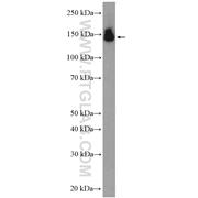 PUM2 Rabbit Polyclonal Antibody (11586-1-AP)
