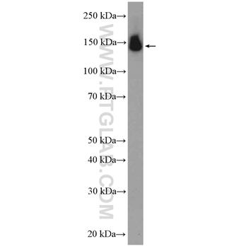 PUM2 Rabbit Polyclonal Antibody (11586-1-AP)
