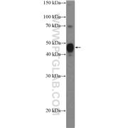 SPDEF Rabbit Polyclonal Antibody (11467-1-AP)