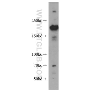 ERCC5 Rabbit Polyclonal Antibody (11331-1-AP)