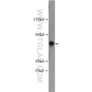 PRAME Rabbit Polyclonal Antibody (11438-1-AP)