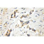 RGS5 Rabbit Polyclonal Antibody (11590-1-AP)