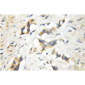 RGS5 Rabbit Polyclonal Antibody (11590-1-AP)