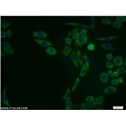 PSMA1 Rabbit Polyclonal Antibody (11175-1-AP)