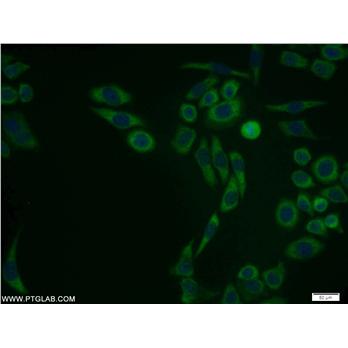 PSMA1 Rabbit Polyclonal Antibody (11175-1-AP)