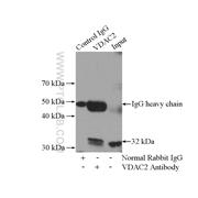 VDAC2 Rabbit Polyclonal Antibody (11663-1-AP)