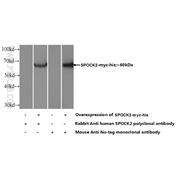 SPOCK2 Rabbit Polyclonal Antibody (11725-1-AP)